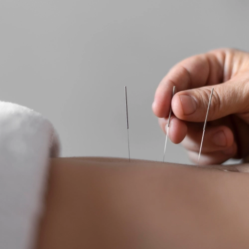 Fotografia de medicina tradicional chinesa